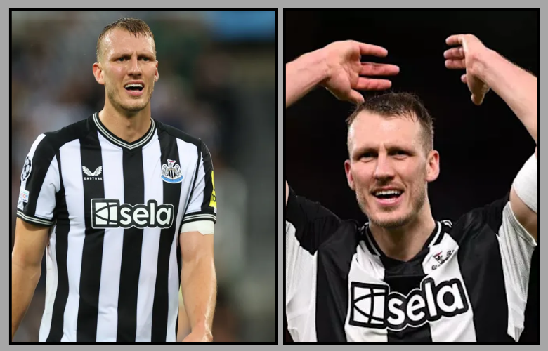 Dan Burn Height: How 6’7″ Defines Newcastle’s Defensive Giant Dan Burn Height: How 6'7" Defines Newcastle’s Defensive Giant